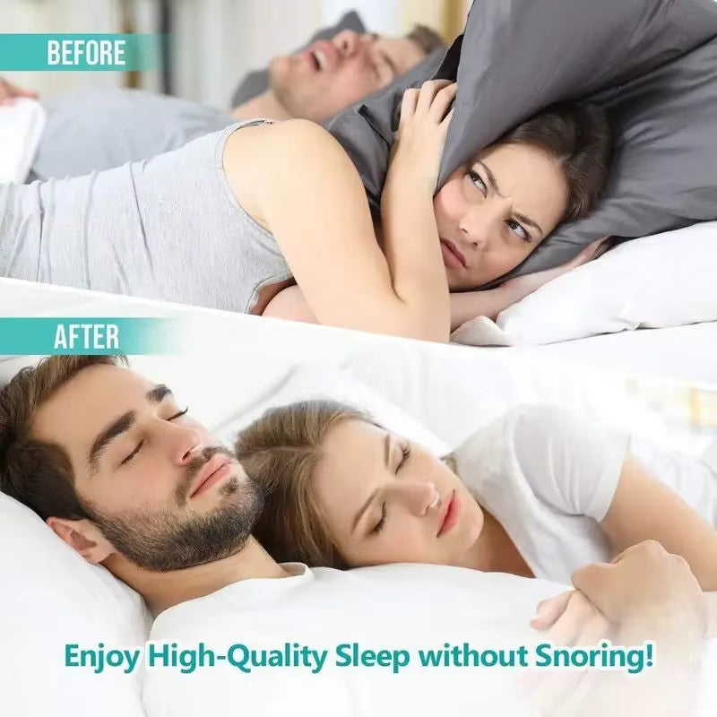 Anti-Snoring Device Snore Stopper Silicone Magnetic Stop Snoring Solution Comfortable & Professional for Men and Women