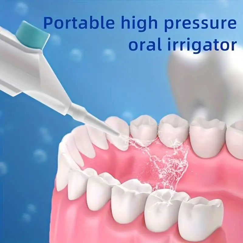 Portable High-Pressure Oral Irrigator – Manual Water Flosser for Teeth Cleaning