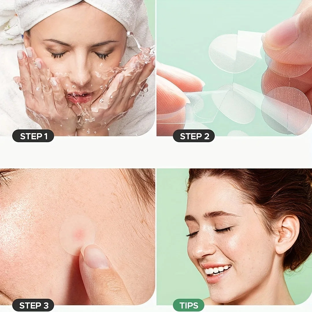 HITWORKER Hydrocolloid Acne Patches – 400/800pcs, Day & Night Use, Fragrance-Free